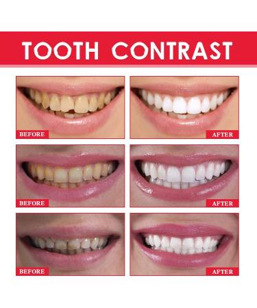 Pure White Luxury Teeth Whitening Kit - 3ml Tao Toothbrush Pink | Best Teeth Whitening Products for Brightening, Stain Removal, and Fresh Breath - Buy Online on GoSupps.com