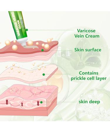 TUITUII Varicose veins spider vein patch spider vein patch veinfree herbal patches antivaricose veins soothing legs veins removal patch 20 g - Buy Online on GoSupps.com