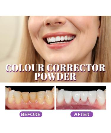 Purple Teeth Whitening Powder | Effective Tooth Whitening & Bleaching | Enhance Your Smile with Visible Results - Buy Online on GoSupps.com