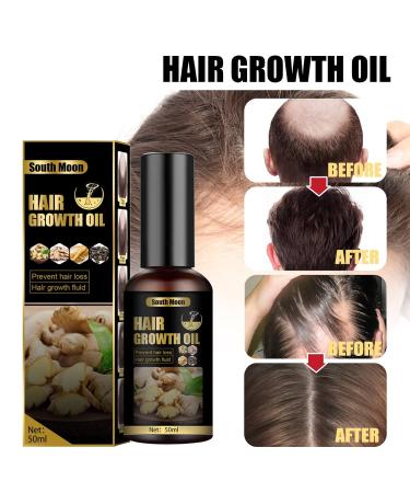 Hair Growth Serum | Accelerate Thicker Fuller Hair - Fast-Acting Formula for All Hair Types - Buy Online on GoSupps.com