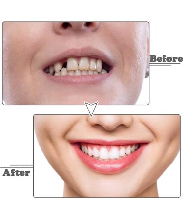 Instant Perfect Snap-On Veneers - 2 Pairs of Comfortable False Teeth for a Perfect Smile | Teeth Whitening Kit Included - Buy Online on GoSupps.com