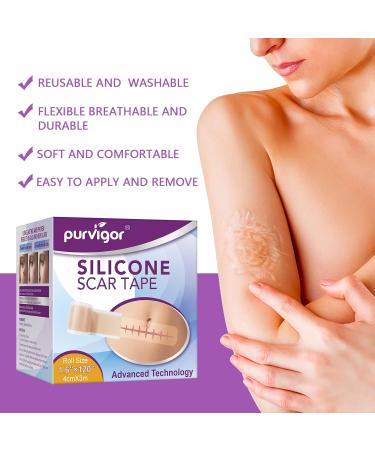 Soothing Silicone Scar Sheets Roll for C-Section, Surgery, Burns, Acne, Stretch Marks - 1.6 x 120 in - Reusable & Effective - Keloid Reduction - Buy Online on GoSupps.com
