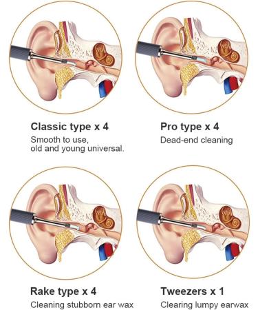 HeiDD Ear Wax Removal Tool Earwax Remover 10 Megapixel HD Ear Wax Removal with Camera Ear Cleaner Wax Removal Tool for Adults Kids Pets Smart Earwax Cleaning Kit (Blue) - Buy Online on GoSupps.com