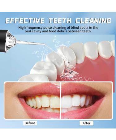 Yunlism Cordless Water Flosser Rechargeable - Waterproof Portable Cordless Dental Oral Irrigator Water flosser for Teeth 220Ml Cleanable Water Tank for Home and Travel - Buy Online on GoSupps.com