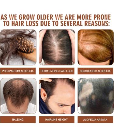 Batana Oil Batana Oil Hair Treat 100% Natural Organic Batana Oil for Healthy Hair Hair Growth Conditioner Hair Smoothing Conditioner For Damage Protective Moisture Recovery (1PC) - Buy Online on GoSupps.com