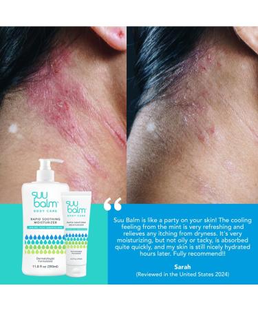 Dual Rapid Itch Relieving Body Moisturiser | Restore Skin Hydration - 11.83 fl oz - International Shipping Available - Buy Online on GoSupps.com
