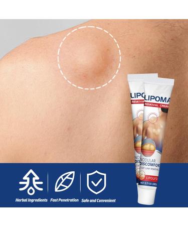 Lipoma Elimination Cream Cr me D' limination des Lipomes V g taux Lipoma Relieving Cream Facile Utiliser par Une Personne la Maison Aussi - Buy Online on GoSupps.com