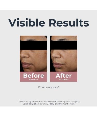 Eucerin Radiant Tone Dual Serum Dark Spot Corrector Dark Spot Serum with Thiamidol and Hyaluronic Acid Helps Visibly Reduce the Look of Persistent Dark Spots 1 Fl Oz Bottle - Buy Online on GoSupps.com