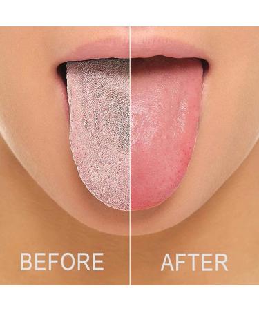 4pcs Stainless Steel Tongue Scrapers | Tongue Cleaner Brush for Adults & Kids | Bad Breath Treatment | Fresher Breath in Seconds - Buy Online on GoSupps.com