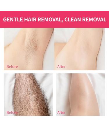 Intimate Hair Removal Gel | Fast-Acting Body Hair Removal Cream | Skin-Friendly for Armpits Legs Hands & Bikini - Aokley - Buy Online on GoSupps.com