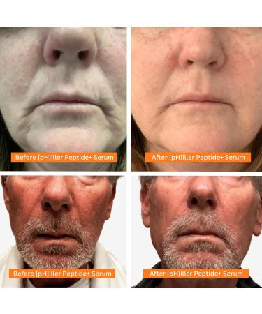 pHiller Peptide Serum - Advanced Anti-Aging Face Tightening Serum with Argireline & Tripeptides | Hydrating Vegan Formula for Fine Lines & Wrinkles (1oz - Buy Online on GoSupps.com