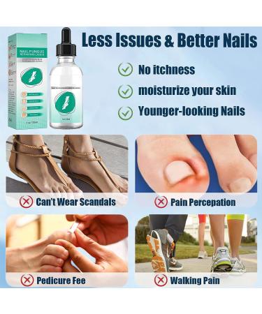 Extra Strength Toe Nail Repair Treatment for Thick, Cracked, Damaged, Discolored Yellow Nails - 30ml - Buy Online on GoSupps.com