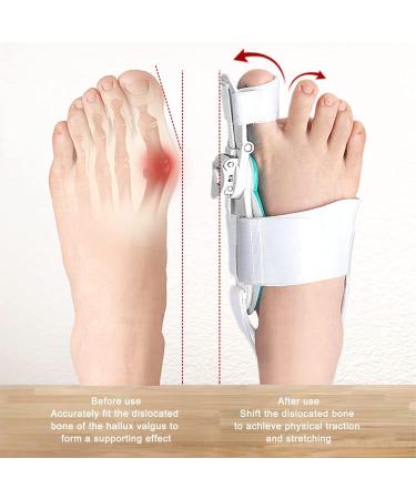 Bunion Valgus Corrector - Adjustable Day Night Orthopedic Toe Straightener (White) - Buy Online on GoSupps.com