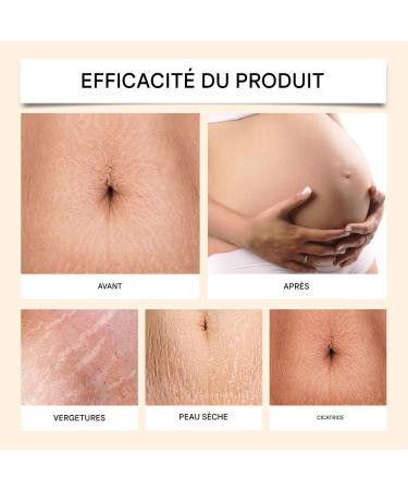  WJnflQN Abdominal Firming Cream 100g Skin Firming Cream | Firms the Stomach for Massage of Abdominal Arm and Buttock Fat - Buy Online on GoSupps.com