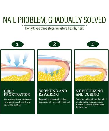  Dous Stop Nails Polish Bitter Nail Water - No Bite Nail Polish - Natural Anti-Nail-Chewing Nail Polish - Prevents Thumb Sucking and Stops Nail Biting - 10ml - Buy Online on GoSupps.com