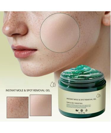  SONGVISON Instant Mole & Spot Removal Gel Dark Pigment Lightening Gel Skin Correcting Moisturizing Serum for Women - Buy Online on GoSupps.com