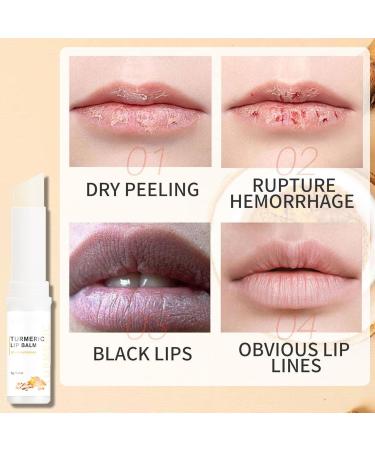 Lip Lightening For Dark Lips Turmeric Lip Balm Hydrating & Brightening Dark Lips Moisturizing Cream Balm Lips Pink Bleaching Daily Lip Care Balm Repair Cracked Chapped Dry Lips - Buy Online on GoSupps.com
