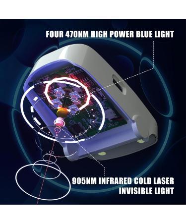 Hanvate Nail Fungus Cleaning Laser Device - LED Screen, Automatic Timer, Touch Button - Home Use Treatment - Buy Online on GoSupps.com