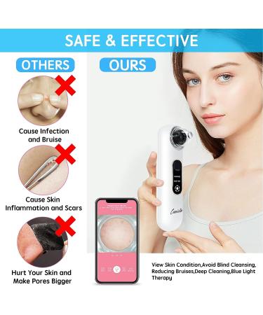 HD Blackhead Remover Pore Vacuum with Camera | Rechargeable Facial Cleaner for Women/Men | 4 Tips Included - Buy Online on GoSupps.com