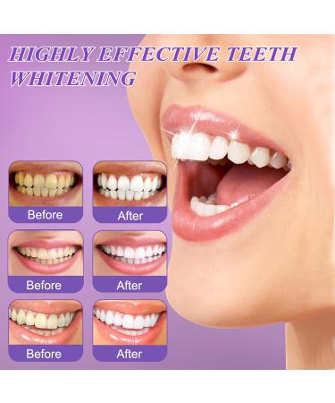 Buy IJHYGD 2 PCS His Smile Lila Toothpaste | Purple Teeth Whitening & Color Corrector Serum for White Teeth - Buy Online on GoSupps.com