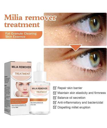 (100% 5 star) 4Pcs Milia Clearing Essence Milia Remover Eye Serum | Milia Remover Milia Spot Treatment | Miliary Repair Essence | Moisturize Skin | Improve Skin Texture for All Skin Types - 30ml/1fl.oz - Buy Online on GoSupps.com