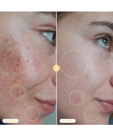 BASE LABORATORIES Hypochlorous Acid Spray for Face & Skin - Travel Size - Facial Toner Spray & Cleaner - Skin Repair Solution helps reduce redness, Irritations, acne - HOCL Molecule Spray 2oz 2 Fl Oz (Pack of 1) - Buy Online on GoSupps.com