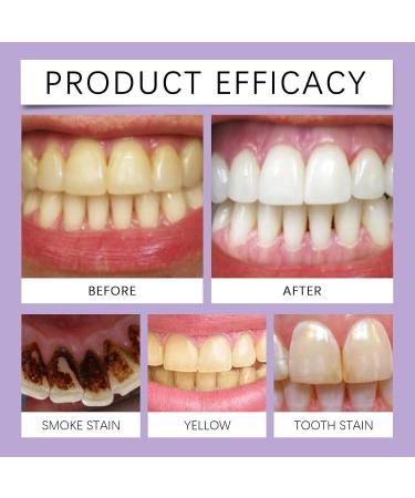 KLYso Gentle Teeth Whitening & Gum Care Powder - Natural Dental Cleaning Formula for Shiny Teeth & Fresh Breath(1PCS) - Buy Online on GoSupps.com