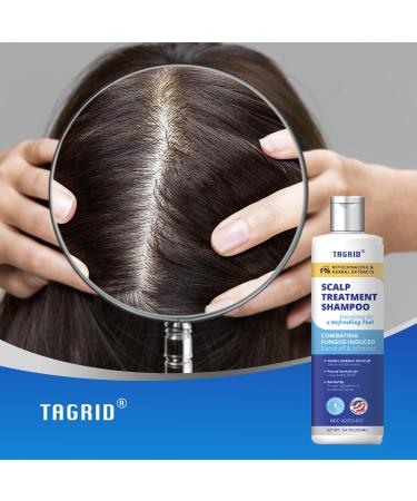 Ketoconazole Shampoo Kit | 1% Dandruff Treatment for Itchy Scalp & Psoriasis | 8.4oz Scalp Relief & Dermatitis Care - Buy Online on GoSupps.com