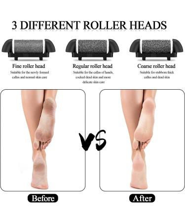Rechargeable Electric Callus Remover + 15-in-1 Pedicure Kit for Feet Care | Foot Scrubber, Dead Skin Remover, Foot Files - Ideal for Women and Men - Buy Online on GoSupps.com
