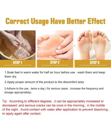 Cracked Heel Repair Foot Cream Cracking Cream Chapping Cream Winter Banana Anti-Cracking Frost Anti-Cracking Frost Feet Moisturizer Skin Repair Cream Anti-Drying Crack Cream - Buy Online on GoSupps.com