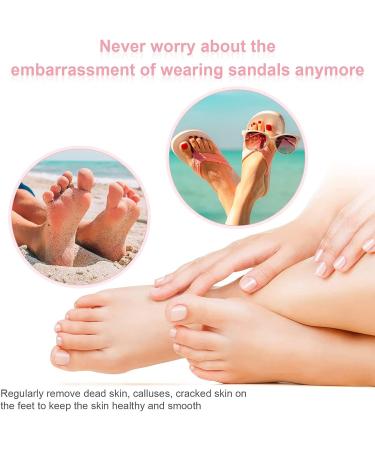 100 Replacement Grinding Paper Slices & Pedicure Tools for Electric Foot Fish Shavers (35mm) - International Shipping Available - Buy Online on GoSupps.com