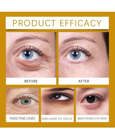 Instant anti-dark circles and wrinkles cream Eye Contour Cream Retinol Anti-Puffiness Under Eye Cream 15g Anti-Wrinkle Eye Contour Care Serum anti-puffiness under the eyes dark circles under the eyes (1pc) - Buy Online on GoSupps.com