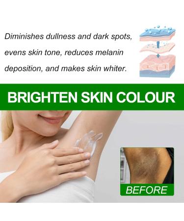 G neric Crema Para Manchas Oscuras En La Cara Crema Para Las Manchas De La Cara 1pcs Para Piel Entrepierna Manchas Codos Piernas Zonas Rodillas Cuello 50ml - Buy Online on GoSupps.com