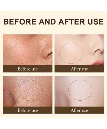 Retinol Face Cream - Anti Aging Face Cream - Anti Wrinkle Face Cream - Skin Lightening Cream - Dark Spot Remover - Day & Night Cream for All Skin Types - Brightening Moisturising Smoothing - Buy Online on GoSupps.com