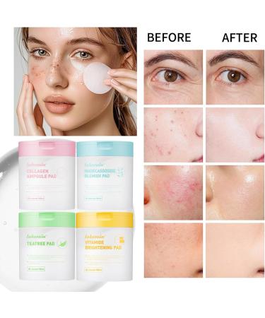 Vitamide Brightening Toner Pads 80 Toner Face Wipes - Vegan Face Hypoallergenic Face Pads With Niacinamide Sea Buckthorn - Radiance Boost Pads For Clear Illuminate Skin (Orange-Vitamin) - Buy Online on GoSupps.com