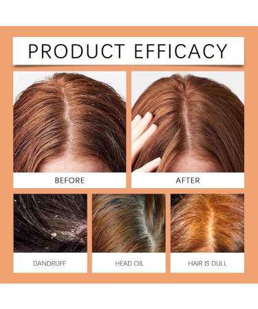 3 pi ces Lissima Gommage Naturel Pour Cuir Chevelu Nettoyant En Profondeur Et Nourrissant Hydratant Et Confortable Formule Douce Pour Tous Les Types De Cheveux - Buy Online on GoSupps.com