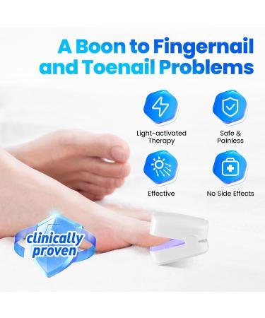 Neulriscn Anti Fungal Nail Treatment Device Nail Fungus Laser Treatment Device for Toenails & Fingernails 7 Mins Per Day 910nm Infrared Light 460nm Blue Light for Nails Onychomycosis Use at Home - Buy Online on GoSupps.com