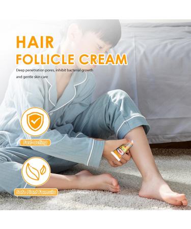 RedOceansM Acne grease and acne cream antipimple gel 20 g acne cream suitable for most skin types - Buy Online on GoSupps.com