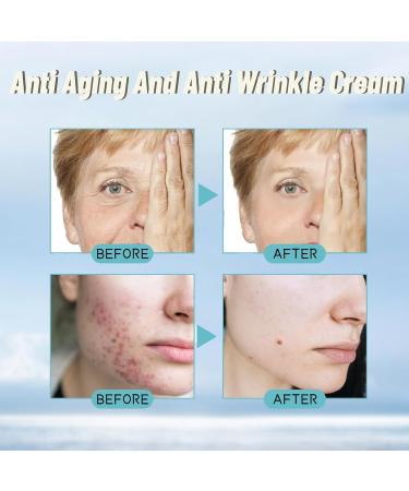 Collagen Retinol Face Cream Face Care Moisturiser For Women Anti-Aging Hyaluronic Acid Face Moisturiser Acne Redness Reducing Face Cream Hydrating Face Cream Face Cream For Mature Skin - Buy Online on GoSupps.com