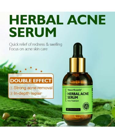 Rosarden Anti Acne Serum for Face Natural Herbal Face Serum for Improvement Pimples Pore Acne Scar Anti Pimple Serum Face Care for All Skin Types of Acne - Buy Online on GoSupps.com