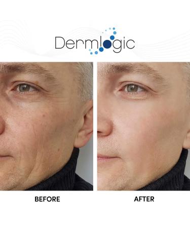 15% Glycolic Cream: Natural Anti-Aging Exfoliator for Smooth, Youthful Skin - A.H.A & Green Tea Moisturizer for Face & Body - Buy Online on GoSupps.com