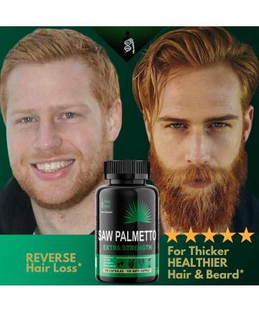 Saw Palmetto DHT Blocker Supplement - Prostate Health Support, Hair Loss Prevention, Hair Growth Vitamins - Organic Beta Sitosterol 500mg - Men & Women - Buy Online on GoSupps.com
