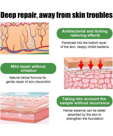 Herbal Eczema Ointment - 3 Pieces for Itch Relief Redness Reduction & Moisturizing | Fast Absorbing Herbal Extracts - Buy Online on GoSupps.com
