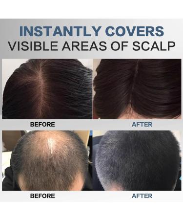 Approach Powder for Men & Women - Dark Gray Hair Sealing Base Powder with Mirror Sponge | Hair Attachment & Shading Concealer for Thin Hair - Buy Online on GoSupps.com