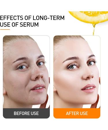 Memonotry Vitamin C Serum with Hyaluronic Acid - Anti Aging, Pore Minimizer, Acne Scar & Dark Spot Remover - 30.00 ml (Pack of 1) - Buy Online on GoSupps.com