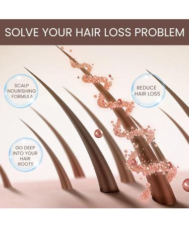 Herbal hair growth serum anti-hair loss hair cream hair growth serum against hair loss for women and men strengthening for healthy hair growth ginger hair oil rapid growth hair treatment 30ml - Buy Online on GoSupps.com