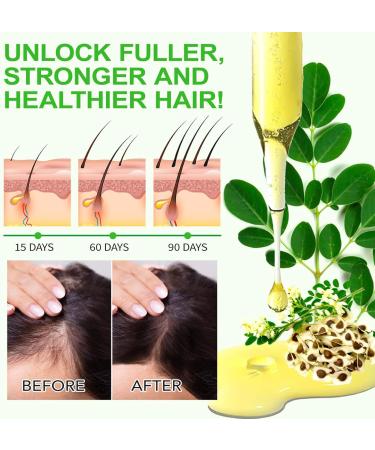 Moringa Oil for Face Hair Scalp & Body Massage Pure Cold Pressed Unrefined Moisturizing & Anti-Aging Hair Growth Nourishing - Buy Online on GoSupps.com