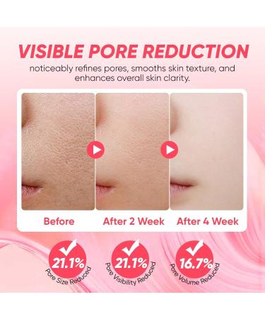 Cyano Pink Spicule Serum + Picotonic Shot Ampoule Duo - Korean Serum for Face with Alpha Arbutin Niacinamide Calcium - Buy Online on GoSupps.com