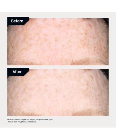 Revision Skincare Intellishade | 5-in-1 Anti-Aging Tinted Moisturizer SPF 45 - Hydrate Protect & Conceal | 1.7oz TruPhysical Clear - Buy Online on GoSupps.com