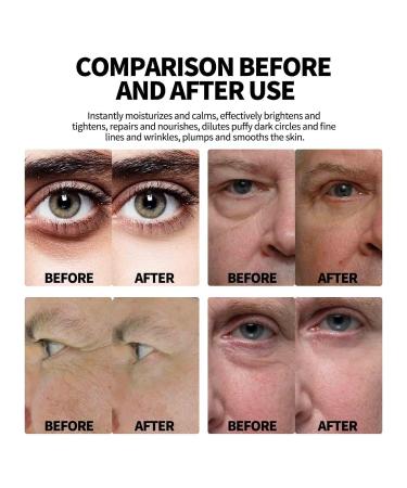 Energetic Eye Roller for Men with Hyaluronic Acid and Vitamin C - Depuffing, Anti-Aging Serum for Dark Circles and Puffiness - 1PC - Buy Online on GoSupps.com